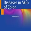 Understanding Diseases in Skin of Color (PDF)