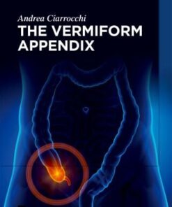 The Vermiform Appendix (EPUB)