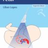 Ecocardiografia Fetal (Portuguese Edition) (EPUB)