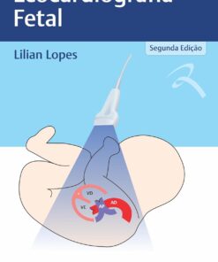 Ecocardiografia Fetal (Portuguese Edition) (EPUB)