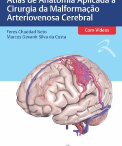 Atlas De Anatomia Aplicada À Cirurgia Da Malformação Arteriovenosa Cerebral (Portuguese Edition) (EPUB)