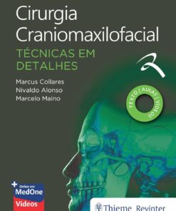 Cirurgia Craniomaxilofacial: Técnicas em Detalhes (Portuguese Edition) (EPUB)
