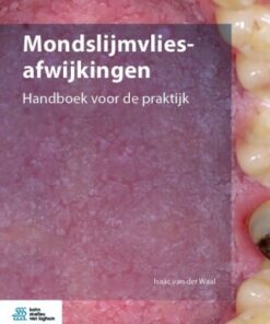Mondslijmvliesafwijkingen (EPUB)