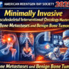 American Roentgen Ray Society Minimally Invasive Musculoskeletal Interventional Oncology Masterclass Bone Metastases and Benign Bone Tumors 2025