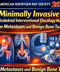 American Roentgen Ray Society Minimally Invasive Musculoskeletal Interventional Oncology Masterclass Bone Metastases and Benign Bone Tumors 2025