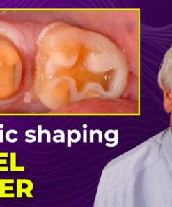OHI-S Biologic Shaping a conservative alternative to crown lengthening 4 lessons 1h 54m
