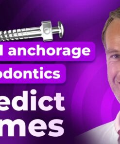 OHI-S Challenging Orthodontic Cases The Use of Skeletal Anchorage 7 lessons 11h 10m