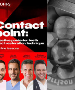 OHI-S Contact point effective posterior teeth direct restoration technique 7 lession 8h 6m