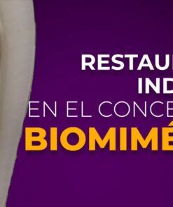 OHI-S Restauración indirecta en el concepto de biomimética Spanish