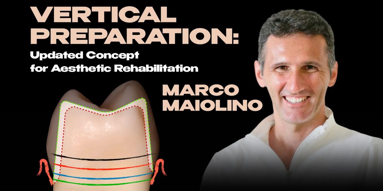 OHI-S Vertical Preparation Updated Concept for Aesthetic Rehabilitation 17 lessons 8h 44m