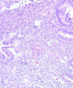 Oakstone Gynecologic Pathology 2026