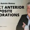 Osteocom Direct Anterior Composite Restorations