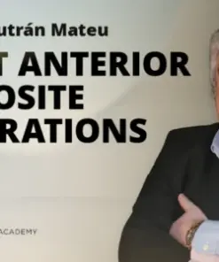 Osteocom Direct Anterior Composite Restorations