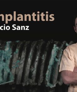 Osteocom Peri-implantitis by Ignacio Sanz