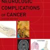 Neurologic Complications of Cancer (Contemporary Neurology Series Book 73), 2nd edition (PDF)
