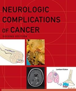 Neurologic Complications of Cancer (Contemporary Neurology Series Book 73), 2nd edition (PDF)