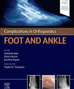 Complications in Orthopaedics: Foot and Ankle (True PDF)
