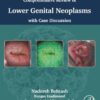 Comprehensive review of lower genital neoplasms: With case discussion (PDF)