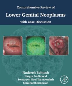 Comprehensive review of lower genital neoplasms: With case discussion (PDF)