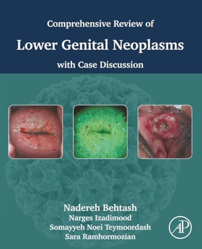 Comprehensive review of lower genital neoplasms: With case discussion (PDF) Comprehensive review of lower genital neoplasms: With case discussion (PDF)