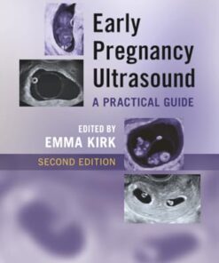 Early Pregnancy Ultrasound, 2nd edition (EPUB)
