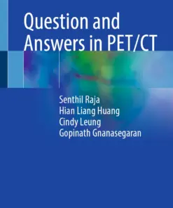 Question and Answers in PET/CT