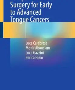 Compartmental Surgery for Early to Advanced Tongue Cancers