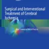 Surgical and Interventional Treatment of Cerebral Ischemia : Basic Science to Clinical Practice