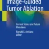 Image-Guided Tumor Ablation : Current Status and Future Directions