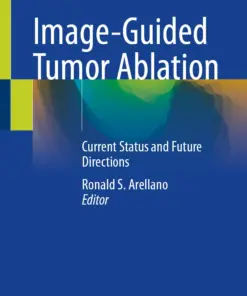 Image-Guided Tumor Ablation : Current Status and Future Directions