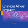 Cutaneous Adnexal Neoplasms