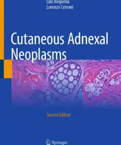 Cutaneous Adnexal Neoplasms