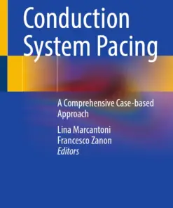 Conduction System Pacing : A Comprehensive Case-based Approach