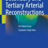 Secondary and Tertiary Arterial Reconstructions : 50 Clinical Cases