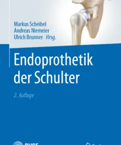 Endoprothetik der Schulter