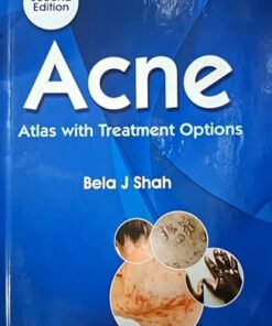 Acne: Atlas With Treatment Option, 2nd edition (PDF)