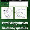 Fetal Arrhythmias and Cardiomyopathies – simplified (AZW3 + EPUB + Converted PDF)
