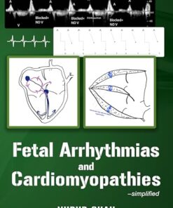 Fetal Arrhythmias and Cardiomyopathies – simplified (AZW3 + EPUB + Converted PDF)