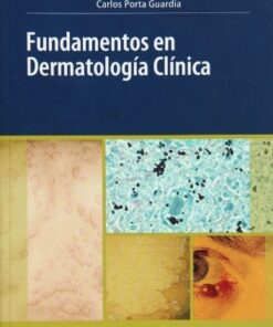 Fundamentos en Dermatologia Clinica (Spanish Edition) (PDF)
