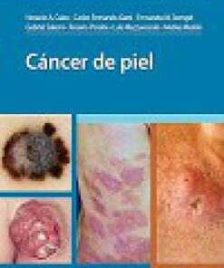 Cáncer de piel (PDF)