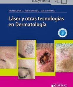 Láser y otras tecnologías en Dermatología (PDF)