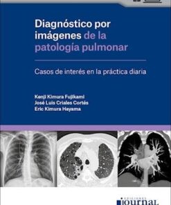 Diagnóstico por Imágenes de la Patología Pulmonar. Casos de Interés en la Práctica Diaria (PDF)