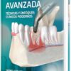 Exodoncia avanzada tecnicas y enfoques clinicos modernos (High Quality Scanned PDF)