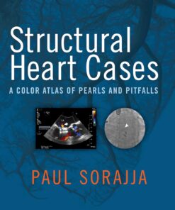 Structural Heart Cases: A Color Atlas of Pearls and Pitfalls (EPUB)