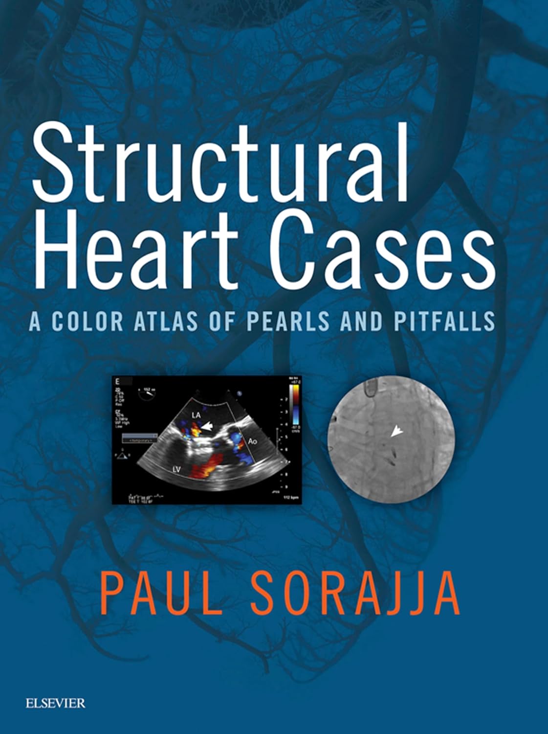 Structural Heart Cases: A Color Atlas of Pearls and Pitfalls (EPUB) Structural Heart Cases: A Color Atlas of Pearls and Pitfalls (EPUB)