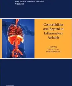 Inflammatory Arthritis Beyond the Joints: Comorbidities and other Manifestations (Volume 18) (Handbook of Systemic Autoimmune Diseases, Volume 18) (EPUB)