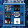 A Practical Handbook of Endocrine Imaging (PDF) A Practical Handbook of Endocrine Imaging (PDF)