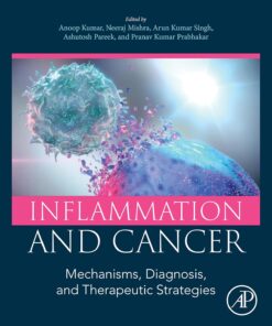 Inflammation and Cancer: Mechanisms, Diagnosis, and Therapeutic Strategies (PDF)