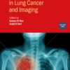 Detection Systems in Lung Cancer and Imaging, Volume 2 (IOP ebooks) (PDF)