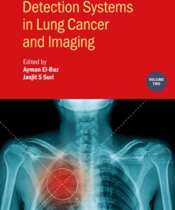 Detection Systems in Lung Cancer and Imaging, Volume 2 (IOP ebooks) (PDF)